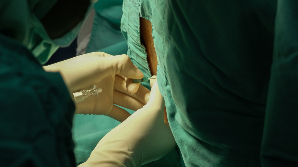 médico fazendo procedimento de infiltração na coluna lombar no paciente